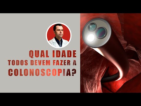 Vídeo: Quantas Vezes Você Deve Fazer Uma Colonoscopia? Por Idade E História Da Família