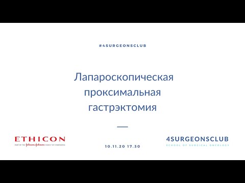 Лапароскопическая проксимальная гастрэктомия