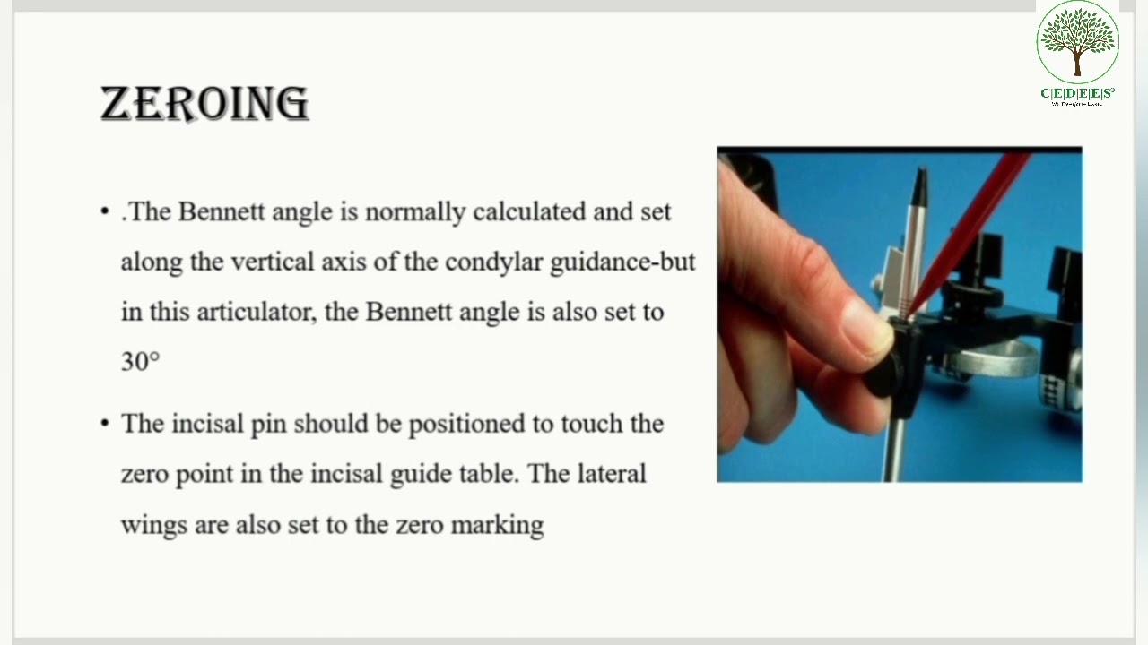 Mounting Casts on Hanau Articulator. YouTube