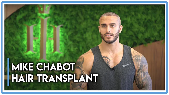 Celebrity Hair Transplant: Mike Chabot from Canada