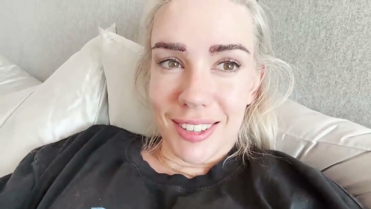 I got an Eyebrow Transplant | Before & After VLOG