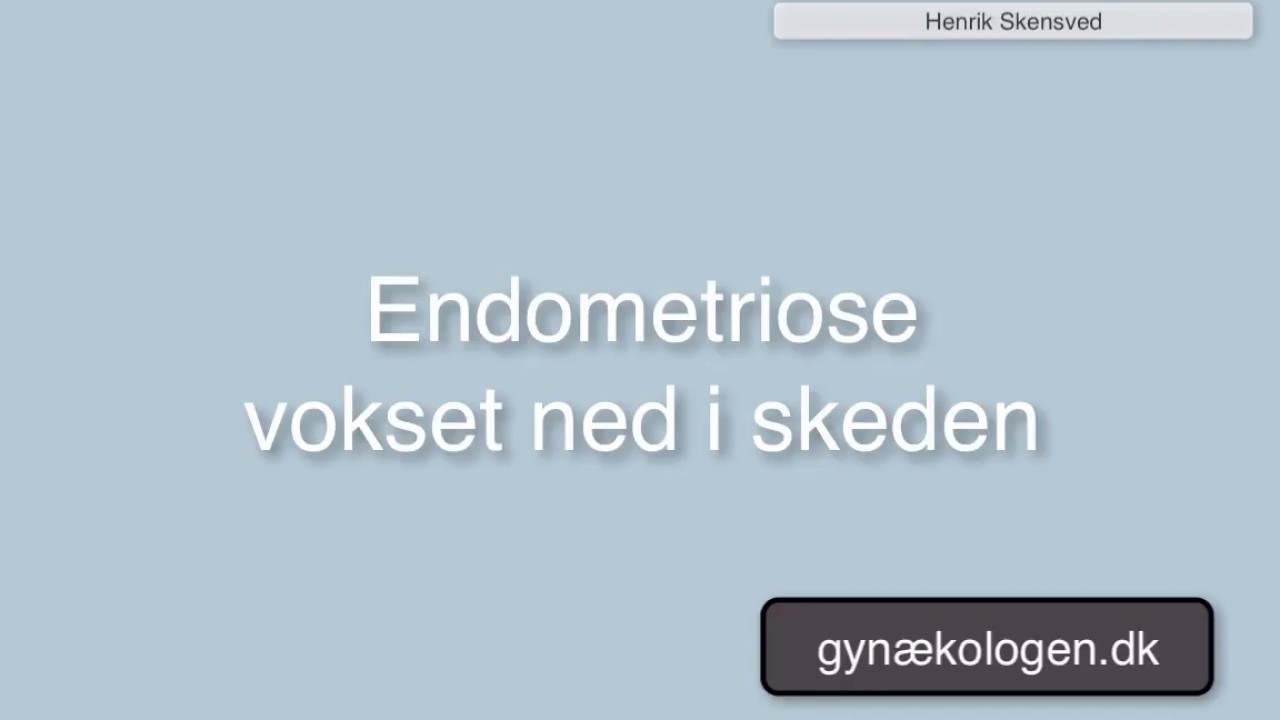 Hvorledes sig? - Gynaekologen