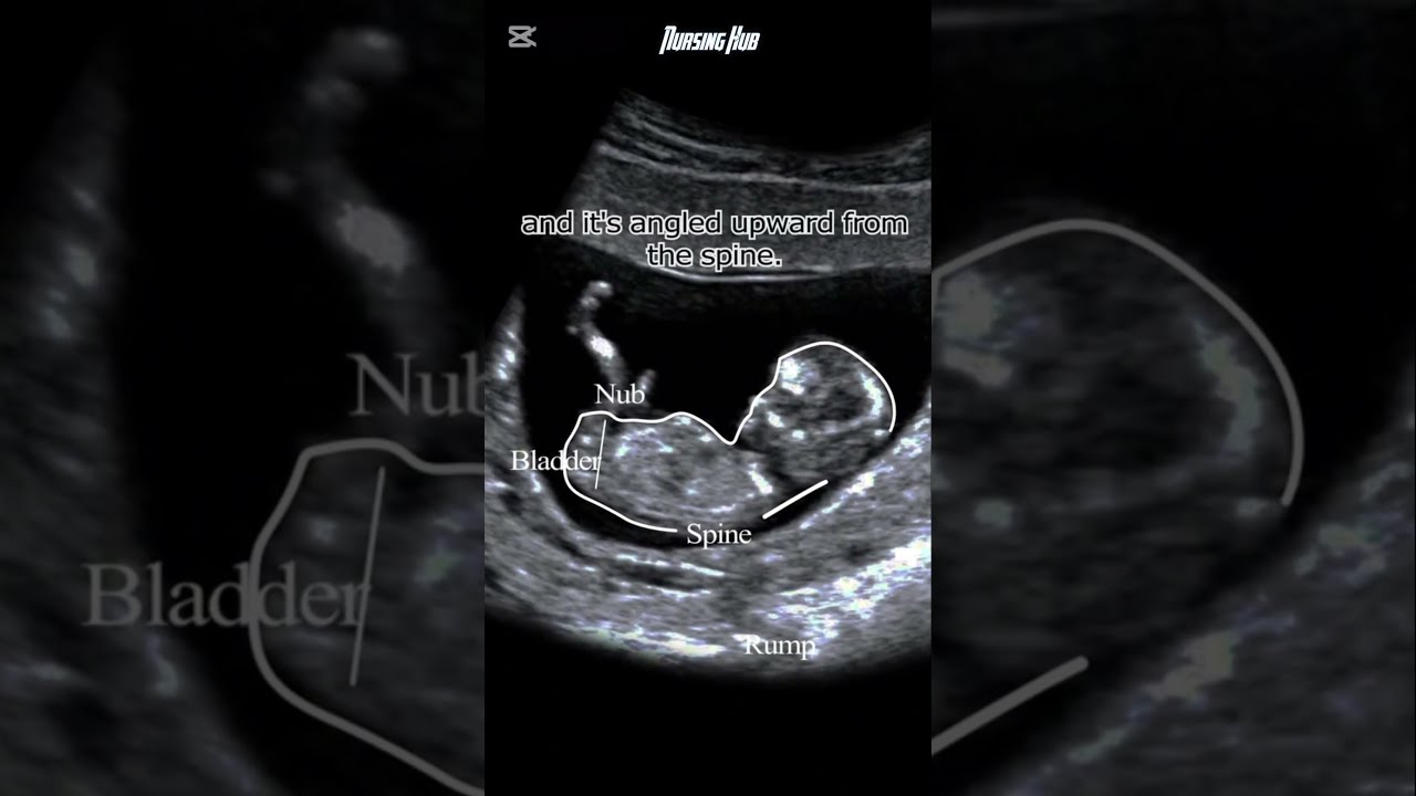 How To Know If It S Baby Girl Or Boy In Womb Pregnancy Test Medical Nursing Science