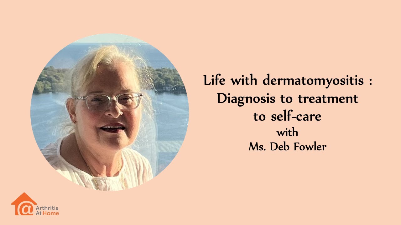 Arthritis At Home 265 – Life with dermatomyositis: Diagnosis to treatment to self-care