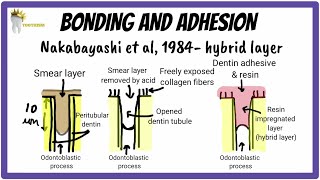 Enamel and Dentin Bonding Made SUPER EASY | Dental Materials