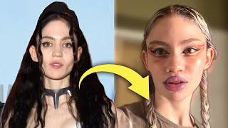 Grimes Admits to Plastic Surgery: Is this the Start of the New Transparency Era?