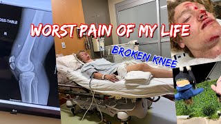 I BROKE MY KNEE (Surgery)