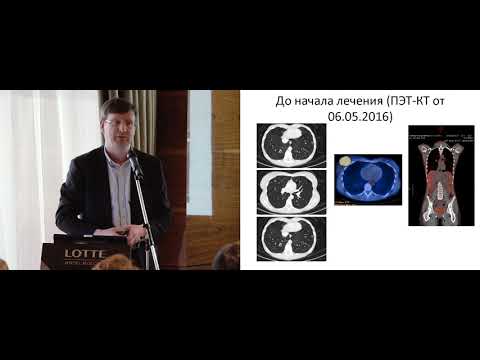 Клинический случай терапии HER2-положительного рака молочной железы