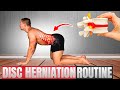 Disc Herniation Pain When You Cough or Sneeze? 3 Steps for FAST Relief