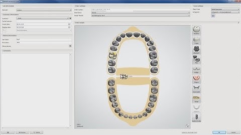 Receiving TRIOS® orders in the Dental System™