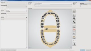 Receiving TRIOS® orders in the Dental System™