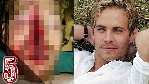 Come è morto l'attore che fa Piton?
