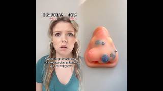 Due To M Population Evryone Has To Vote For Each Other To Stay Or Disappear...