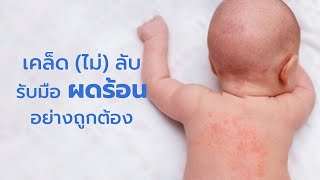 เคล็ดไม่ลับรับมือผดร้อนอย่างถูกต้อง