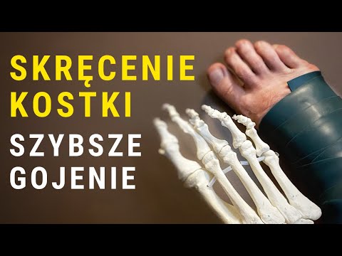 Wideo: 3 sposoby leczenia skręcenia stopy