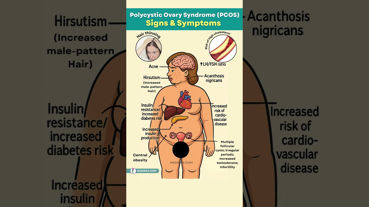 PCOS Signs & Symptoms - What Every Woman Should Know