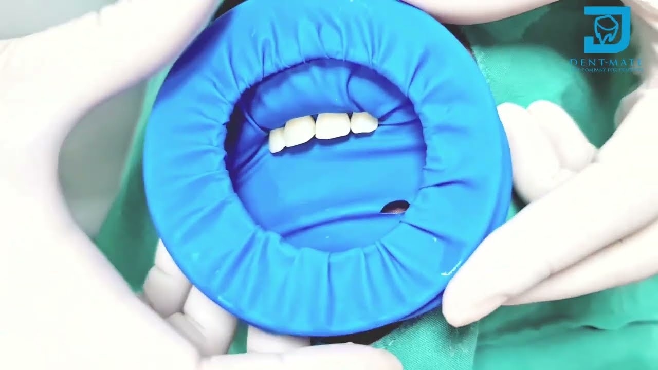 Rubber Dam - Cheek Lip Retractor