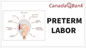 Preterm Labor: Signs, Symptoms, Diagnosis & Treatment | CanadaQBank