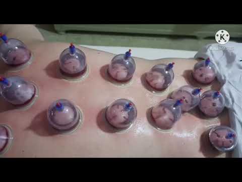 حجامة مع الفوطة النارية 