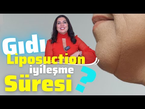 Gıdı liposuction sonrası iyileşme süresi ne kadardır? | Dr.Leyla ARVAS | Quartz Clinique