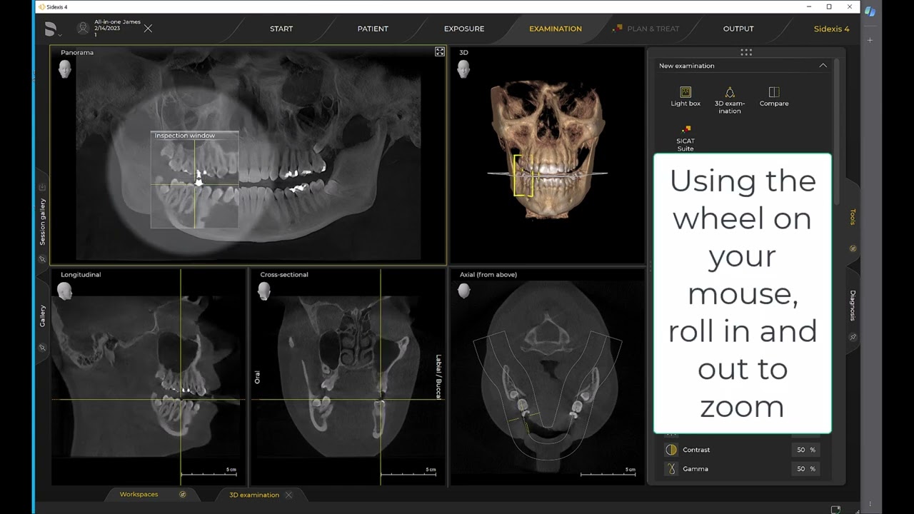 Imaging Training Session 21: Sidexis 4 - Utilizing the Inspection Window