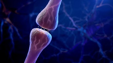 Can exercise reduce your risk of developing Alzheimer