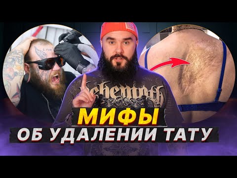 УДАЛЕНИЕ татуировок вызывает РАК? / Главные мифы про сведение тату