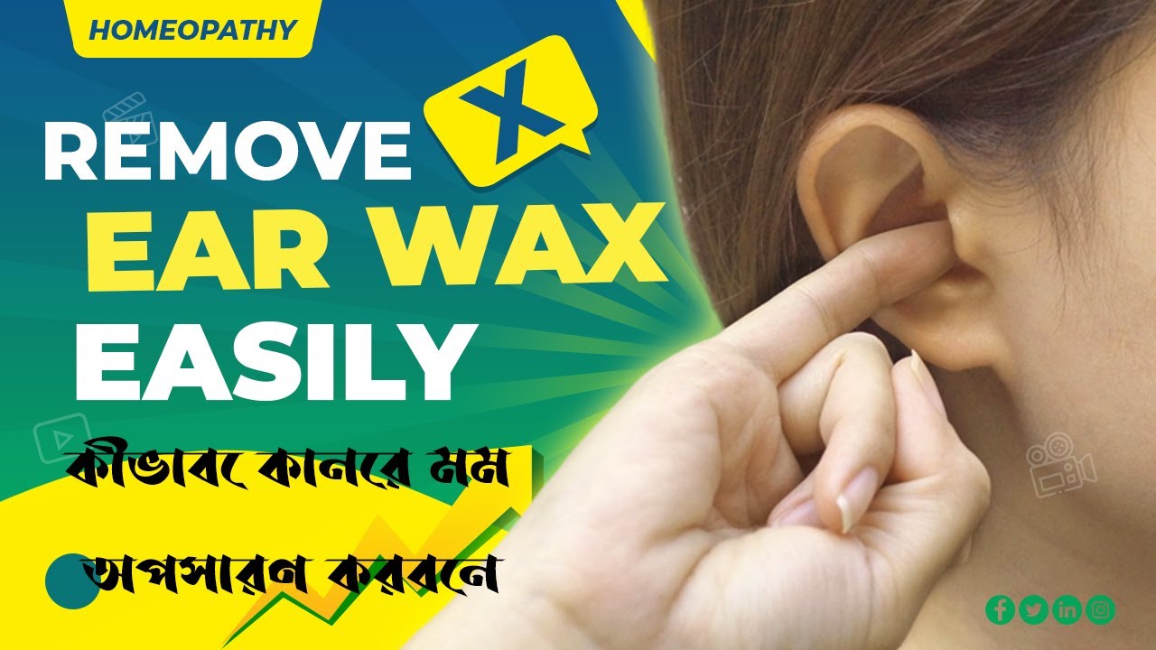 Ear wax removal Bangla কি ভাবে কানের ময়লা বার করবেন ? YouTube