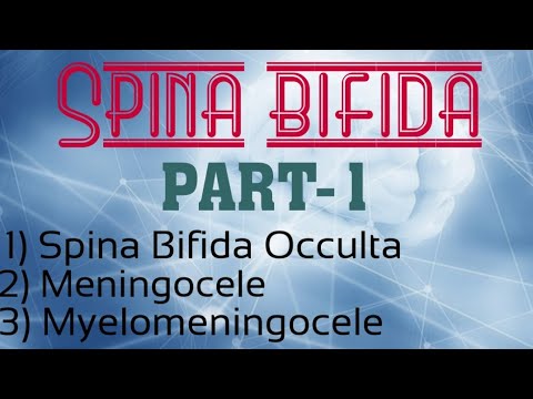 Video: Si e diagnostikoni spina bifida occulta?