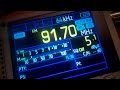 FM Bandscan Prague (87.5-95.0 MHz)