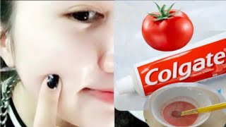 Mix tomato and toothpaste Skin whitening and anti-wrinkle mask skincare skincareroutine