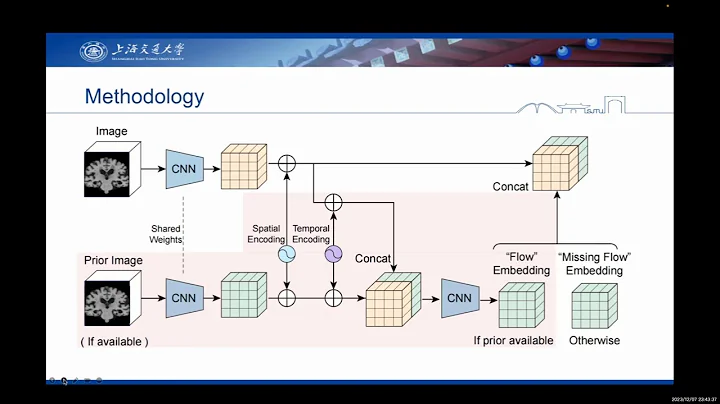 Longformer: Longitudinal Transformer for Alzheimer’s Disease Classification With Structural MRIs