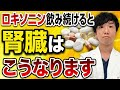 【50代60代要注意】ロキソニンや解熱鎮痛薬を毎日飲み続けると腎臓に起こる５つの変化。意外な副作用について腎臓の専門医が解説
