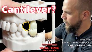 Real Time Tech Talk: Cantilever on a single-unit implant crown.