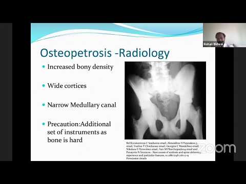 Metabolic Bone disease for the FRCS Orth