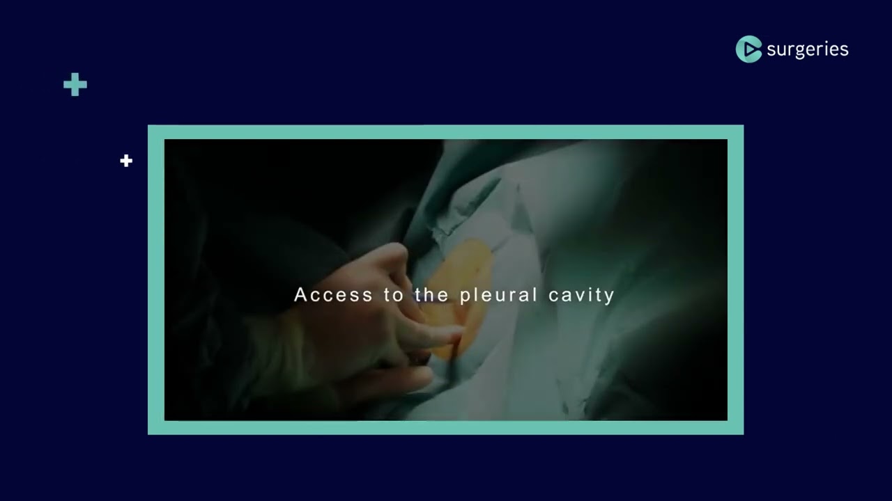 FEATURED: Surgical insertion of a chest tube 