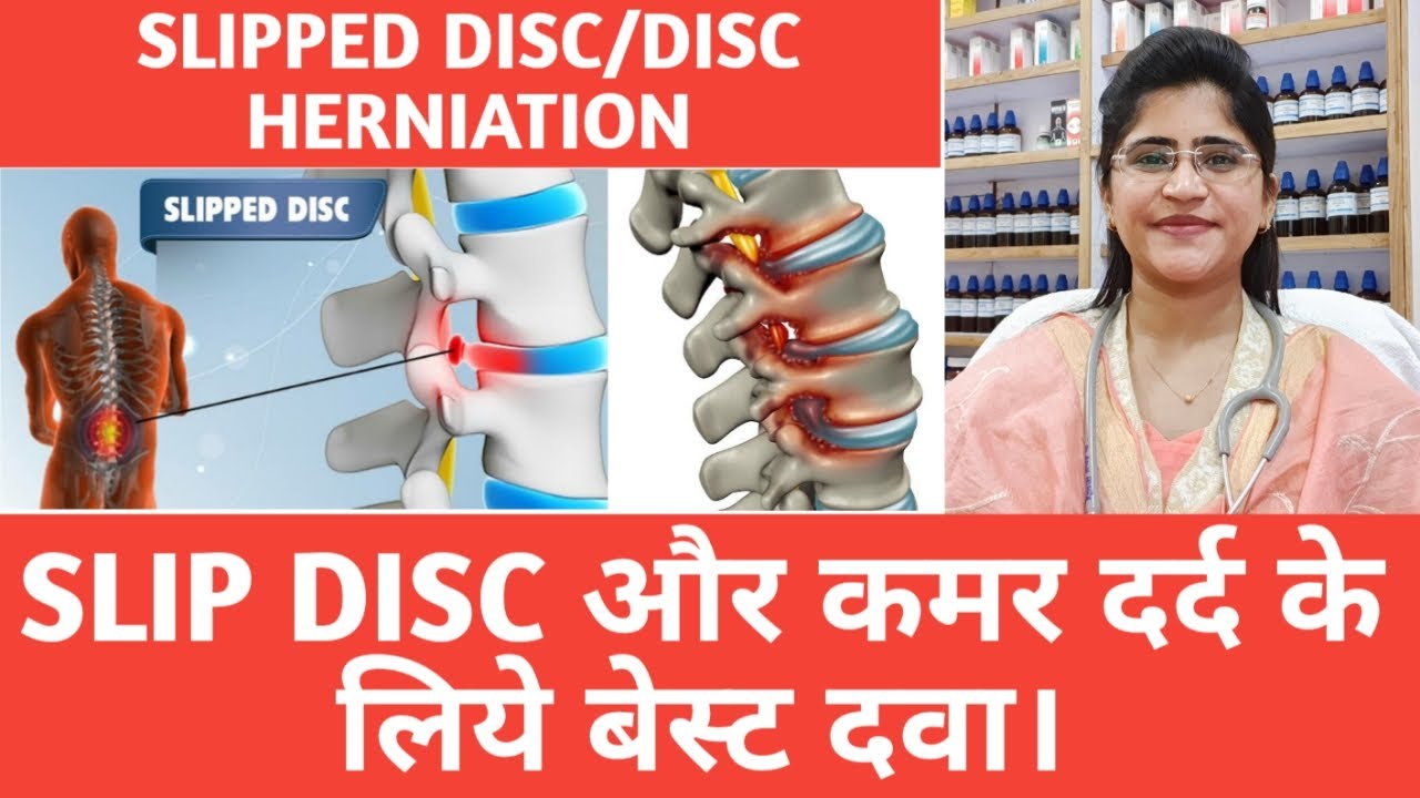 Slipped disc।। Herniated disc।।Homeopathic medicine for slip disc