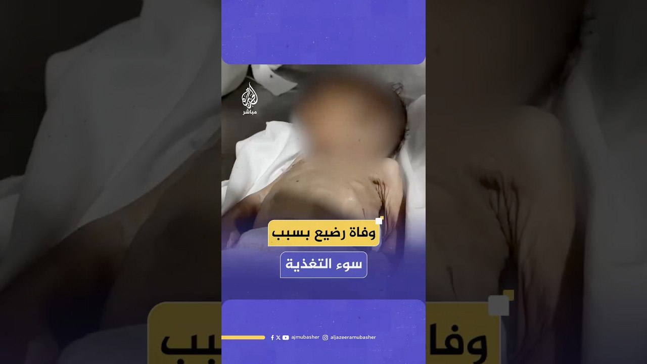 وفاة الرضيع عيد أبو جامع (شهران ونصف) جراء سوء التغذية بمجمع ناصر الطبي في خان يونس