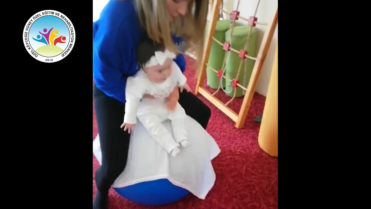 Down Sendromlu bebeklerde fizik tedavinin önemi