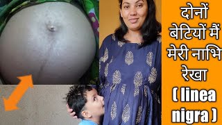 #linea nigra(काली लाइन)#babyboy or girl with prove #my personal experience#jyotikimothivlogs