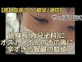 嬉しいこともあったけれどやはり凹む通院日【膀胱皮膚ろう/オストメイト/腎臓内科】
