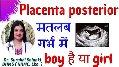 Placenta posterior means boy or girl |  Placenta anterior means boy or girl - DayDayNews