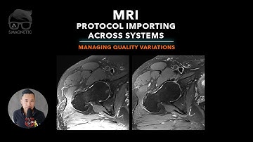 MRI – PROTOCOL IMPORTING ACROSS SYSTEMS: MANAGING QUALITY VARIATIONS