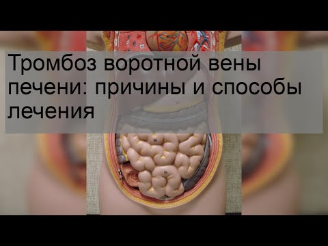 Тромбоз воротной вены печени: причины и способы лечения