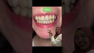 Unleash Your Confident Smile with Dr Clear Aligners!