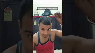 Day 63 Hair Regrowth Challenge #hairgrowthtreatment #hairgrowth #hairloss #day63 #shortvideo