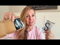 Are these carabiner clips worth it? A closer look