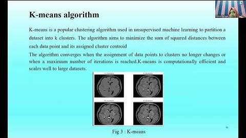 Image Segmentation and Classification using Neural Network