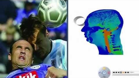 SIMULIA Abaqus - Traumatic Brain Injury Analysis with Abaqus