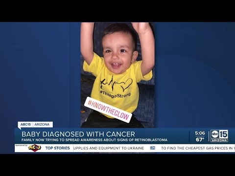 Dieťa s diagnózou rakoviny, rodina šíri správu